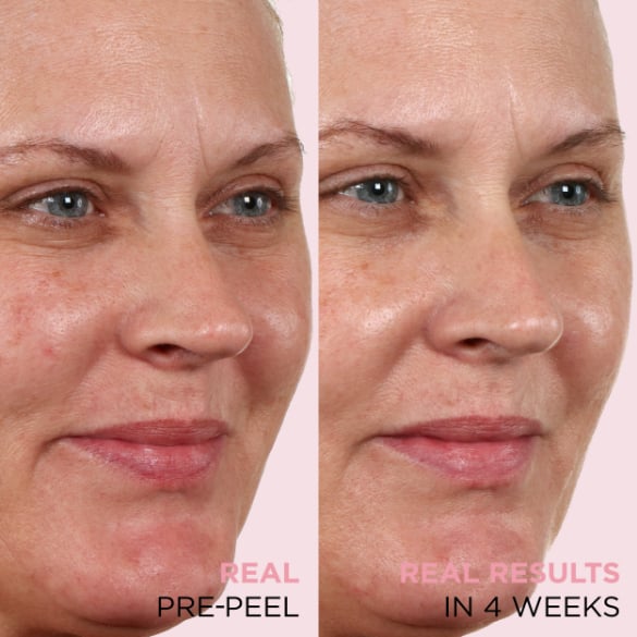 Before and after picture of real results