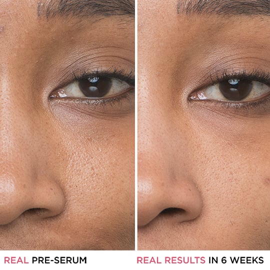 It Cosmetics Glycolic Acid Before and After Using Bye Bye Pores