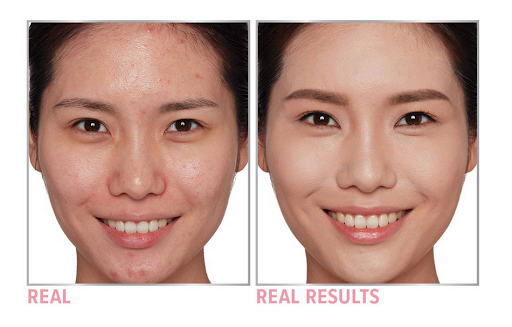 Oily skin before and after photo - IT Cosmetics
