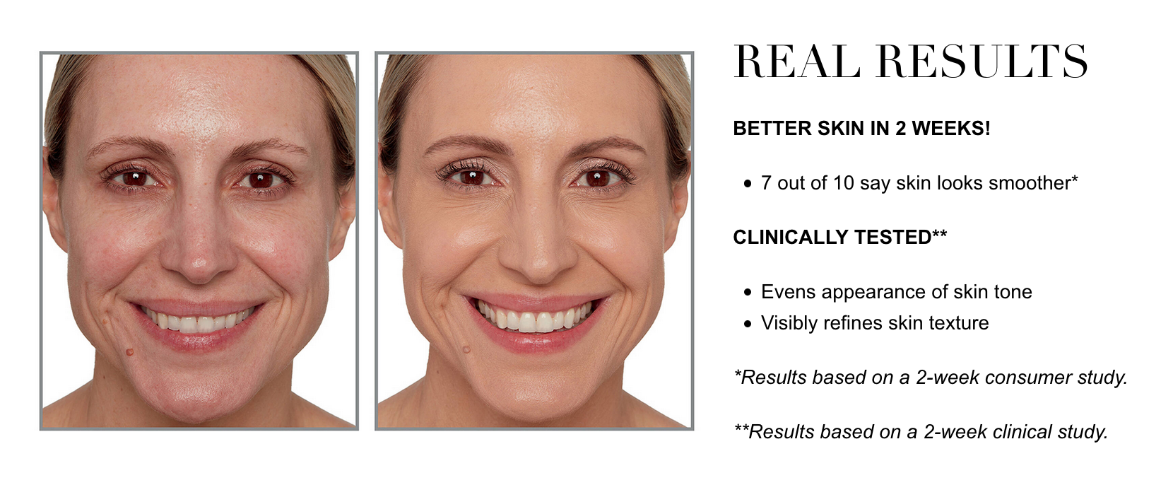 Side By Side of Woman with Skin Results